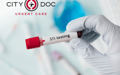 Blog 4 Introducing Rapid STI Testing at CityDoc Urgent Care: Fast, Confidential, and Reliable