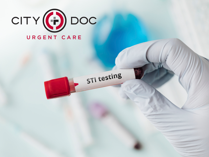 Introducing Rapid STI Testing at CityDoc Urgent Care: Fast, Confidential, and Reliable
